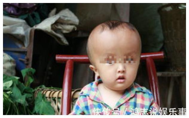 头围|脑袋大的孩子更聪明?错!决定孩子智力的其实是这“两个部位”