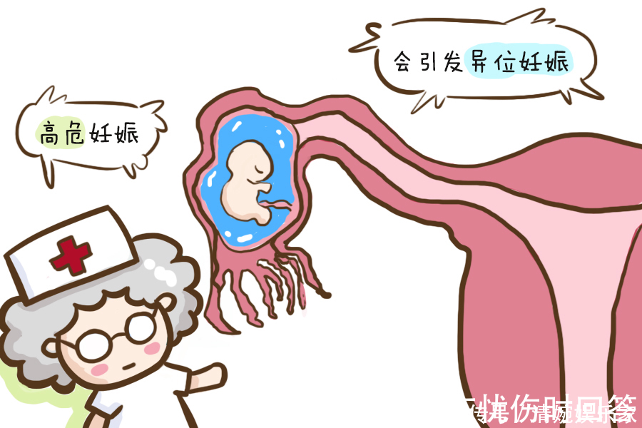 孕妇|孕妈若是有这四个特征，说明可能是“高危”孕妇，可别不当回事儿