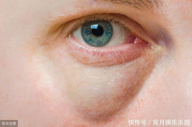 肾健康的人,早上起床时有4个“共同点”,若你占2个那也很幸运