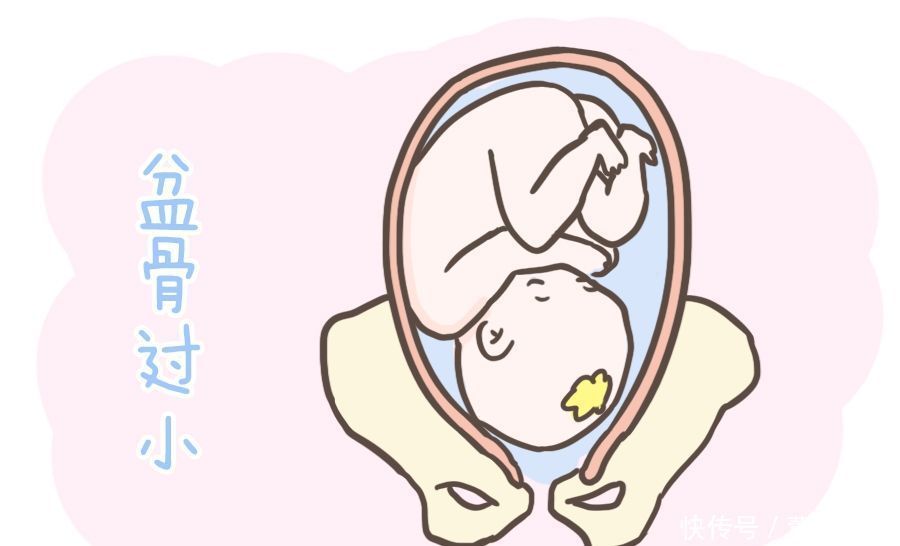 准妈妈第一胎如果是剖宫产,那么第二胎该怎么生看完这篇就懂了