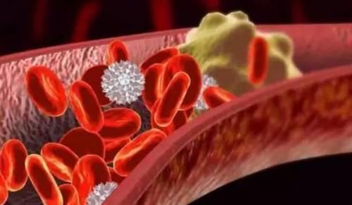 坚果|51岁田先生吃素2年多,突发脑梗,这3种食物升血脂比肥肉还厉害