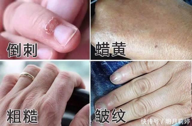 日本变态手霜，效果堪比“换皮”轻轻一抹，双手一夜重回婴儿肌