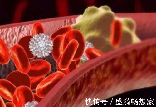 调理|建议中老年,若不缺钱多吃这2物,稳血脂通血管,还不贵