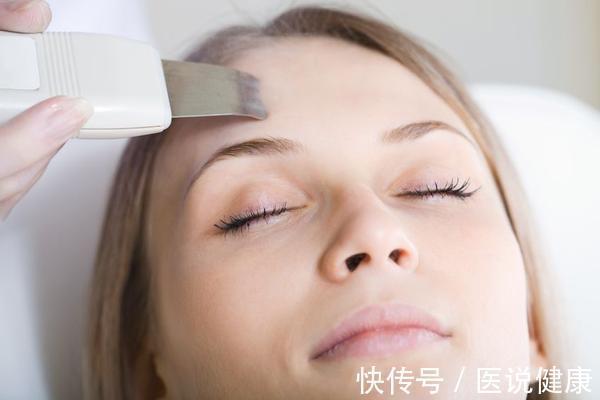 预防|女性不想黄褐斑找上门,不妨坚持这4件事,或能有效预防