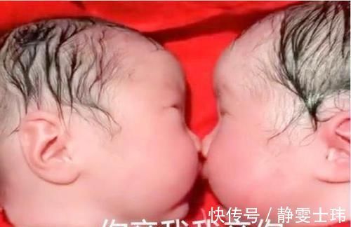 龙凤胎|龙凤胎宝宝刚出生就“秀恩爱”，医生都不忍心拆散，画面太有爱了