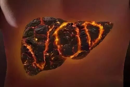 气血不足|失眠不仅是睡眠问题，还可能提示身体有这3个问题，大家最好注意