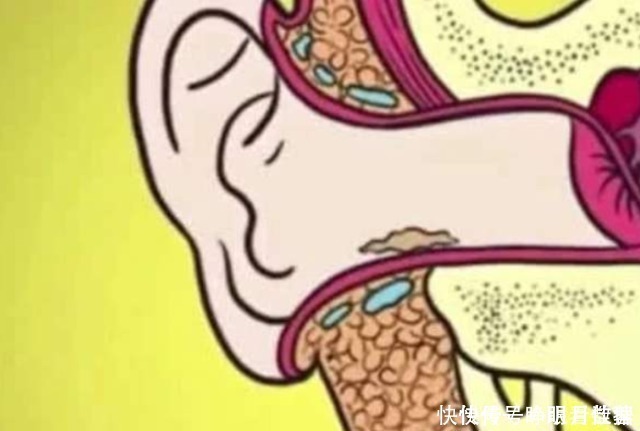 棉签|用棉签掏耳朵到底有多危险?3D动画演示,原理一目了然