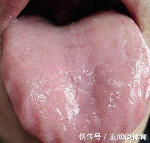 茯苓|养脸不如养脾，3样健脾祛湿好物，一定要吃