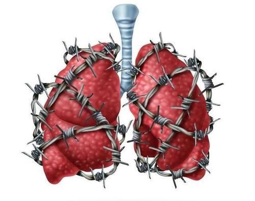 声音嘶哑|尼古丁的“清洁剂”找到了，不是西红柿，平时敞开吃，排出烟毒，肺逐渐白净