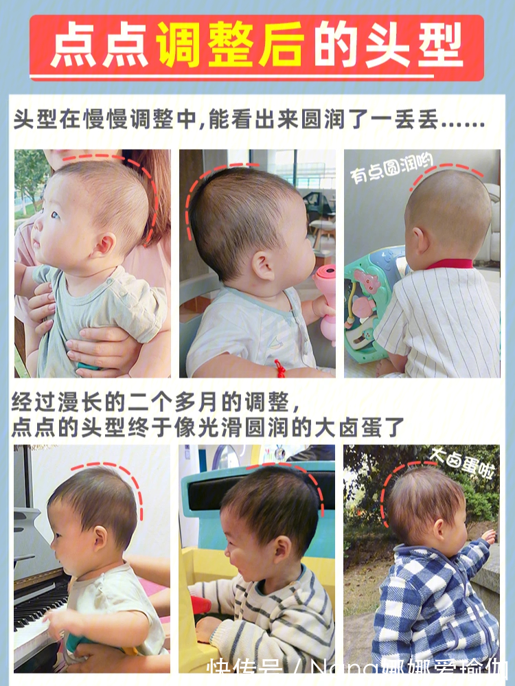 睡姿|宝宝睡圆头矫正头型,保姆级教程来了!