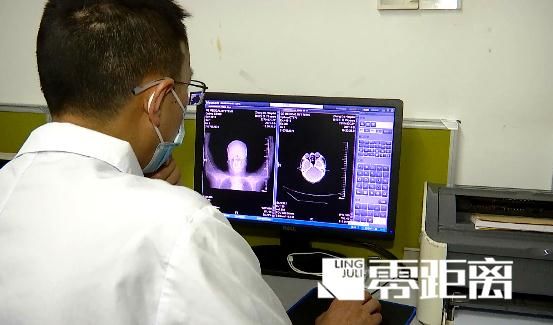 王女士|感冒喉咙痛可以吃冰棒缓解?医生给出适用范围!