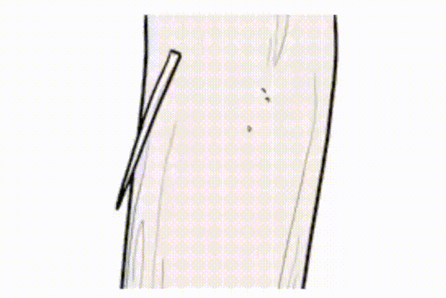 年关|一个被猪蹄噎到,一个被鱼刺卡喉!年关将至,吃东西要注意