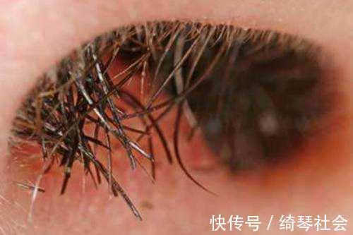 腿毛|腿毛旺盛和腿毛很少的男人,有什么不同专家一次性说清楚