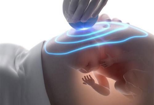 唐氏筛查|为啥很多产妇不愿意“产检”背后三个现实原因,每一个都很扎心