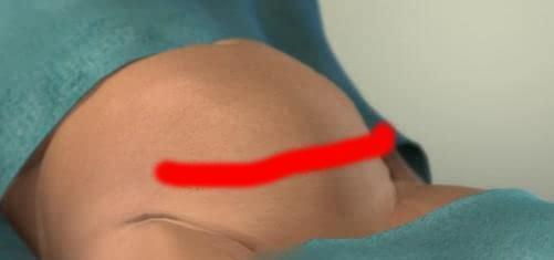 妈妈|剖腹产手术全过程!只有躺在产床上的妈妈,才知道那种滋味