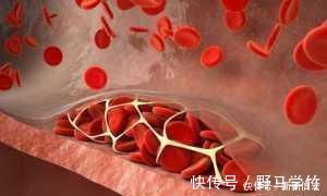 脂质|转告家人：1果是降脂“高手”，经常吃，打扫血管，降甘油三酯