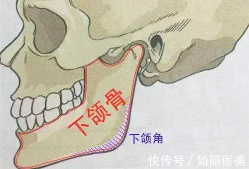 切除 下颌角削骨后有哪些后遗症？术后需要注意事项有哪些