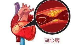 儿茶酚胺|太激动、太生气，老人竟因“心碎”进医院？