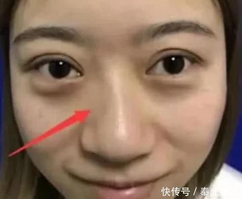 习惯|女生想拥有“婴儿鼻”,起床后坚持这3个习惯,或助你远离“草莓鼻”