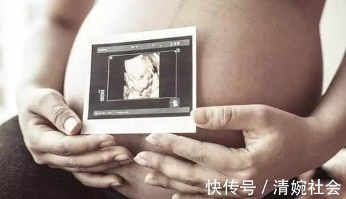 妊娠期|怀孕后,为啥有人孕吐不断,有人却没反应,医生与2个因素有关