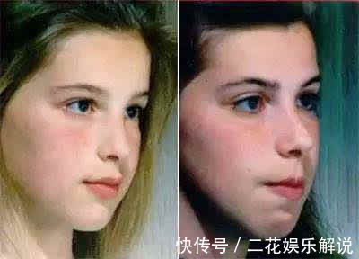 生活习惯|孩子的“容貌”几岁定型？到这个年龄后，颜值不会有太大变化