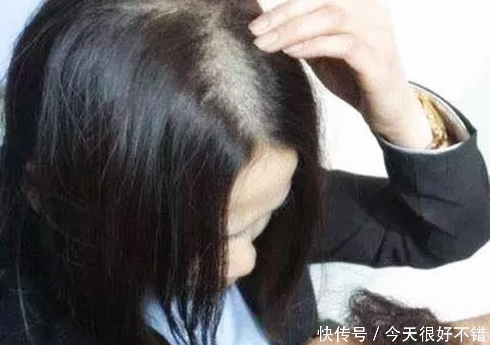 坏习惯|有一种丑叫“孕丑”，孕期这些“坏习惯”，会让孕妈变得越来越丑