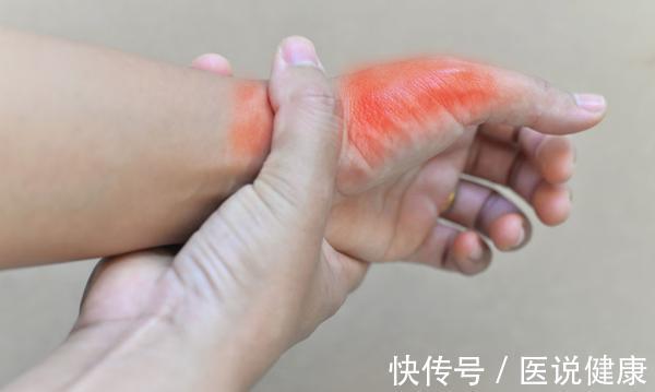 海鲜|痛风发作,不良习惯和饮食只是导火索,了解后,才能有效预防