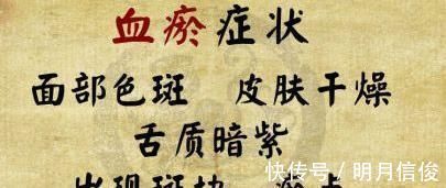 三七|血瘀生百病!清朝医林高手一个2味药的经典配方,从头到脚化瘀血