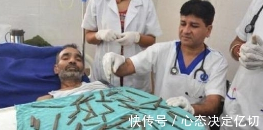 医生|男子深夜吐血，手术开刀后，发现肚子里的东西在场医生?傻住