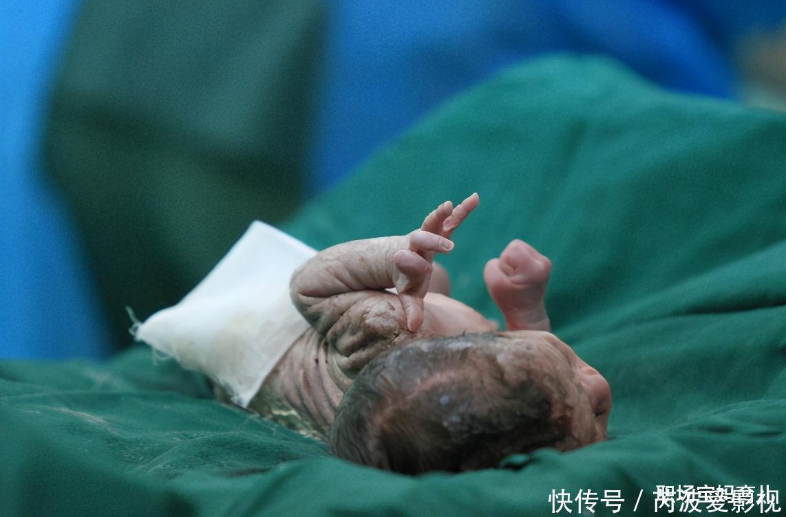 产妇|为什么越来越多的女明星选择剖腹产，而不愿意顺产生娃，原因在这