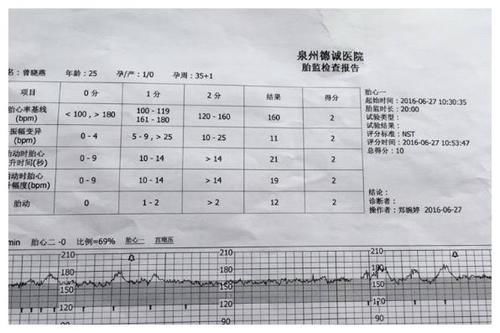 b超单|孕检时,B超单上的这3个数据,可能代表怀了个“小帅哥”