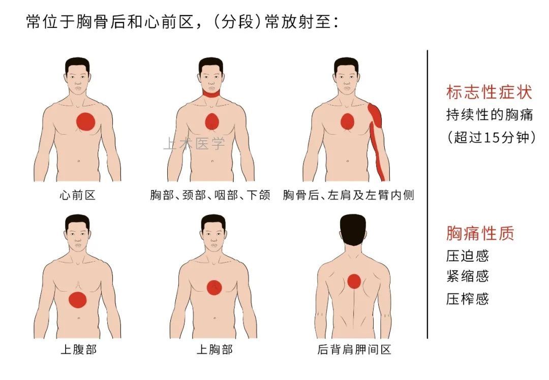 抢救|记住5个急救「黄金时间」，关键时刻能救命