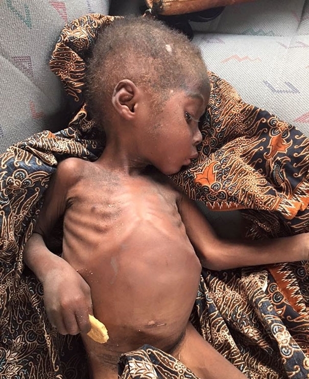 父母|瘦弱男童被父母抛弃,善良美女将他带回家,2年后男童变成了这样