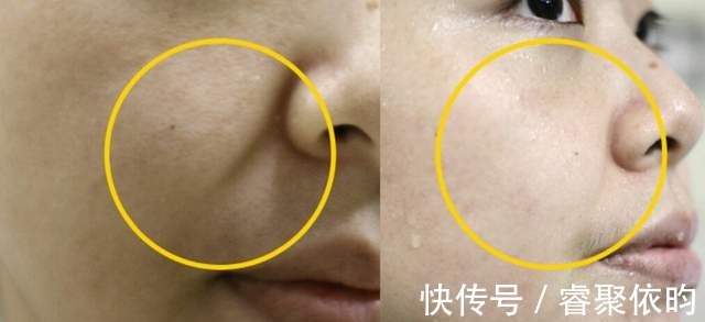 磨砂膏|常见的面部清洁方式有哪些？什么叫做二次清洁？