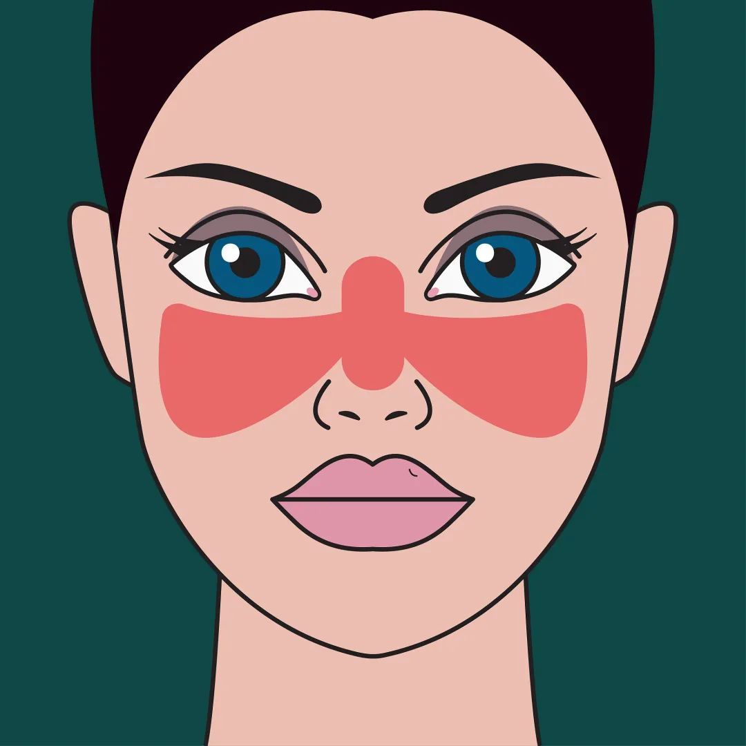 水杨酸|问：换季皮肤不适时该用些什么？