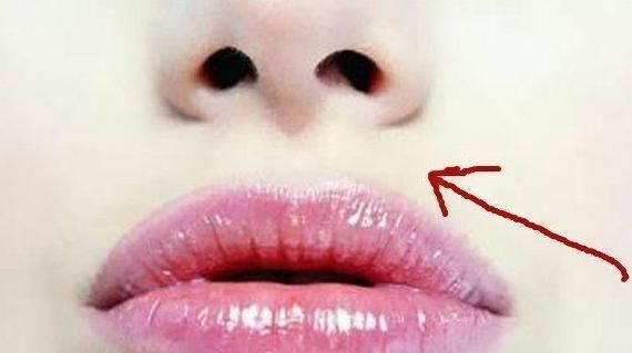人中沟|女人患有妇科病,脸部会出现3个暗号,发现1个就最好去体检