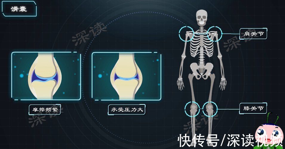 肌肉|肩膀疼痛？胳膊难抬？搞不好会残废？长期加班的亲，小心肩周炎