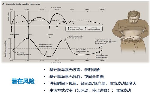 糖友|美敦力胰岛素泵告诉你为什么戴泵比打针好？