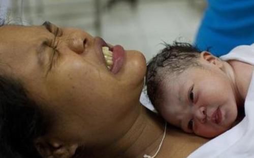 都是剖腹产，被压肚子的产妇和不压肚子的产妇，到底有啥差别？