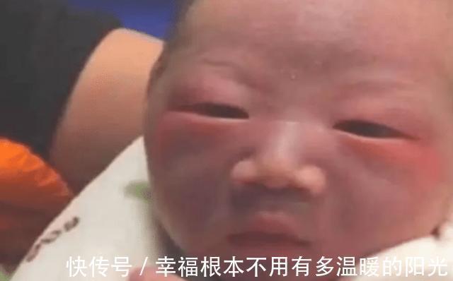 胎脂|新生儿因太“丑”遭全家嫌弃,医生却说很好看,满月后见分晓