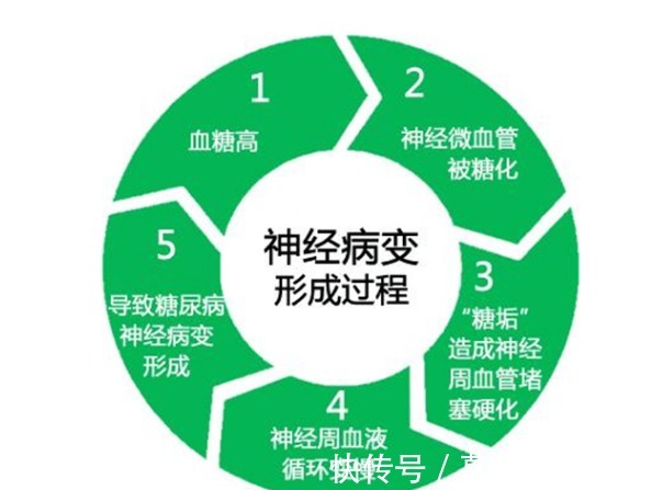 患者|糖尿病人什么时候开始服用维生素B12?吃多长时间?