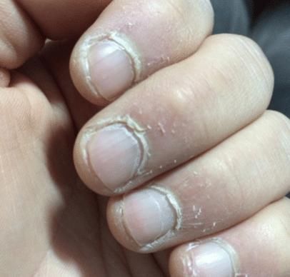 肝脏|身体这个“部位”断裂,说明你的肝脏病变了,不要大意