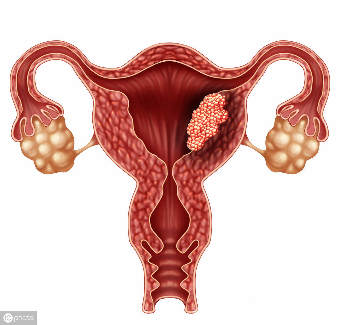 他是子宫的“清洁工”,每天吃一点,活血化瘀,子宫会越来越健康