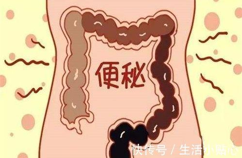 便秘|便秘怎么快速排便，用对这几个方法，让大便像子弹般快速排出