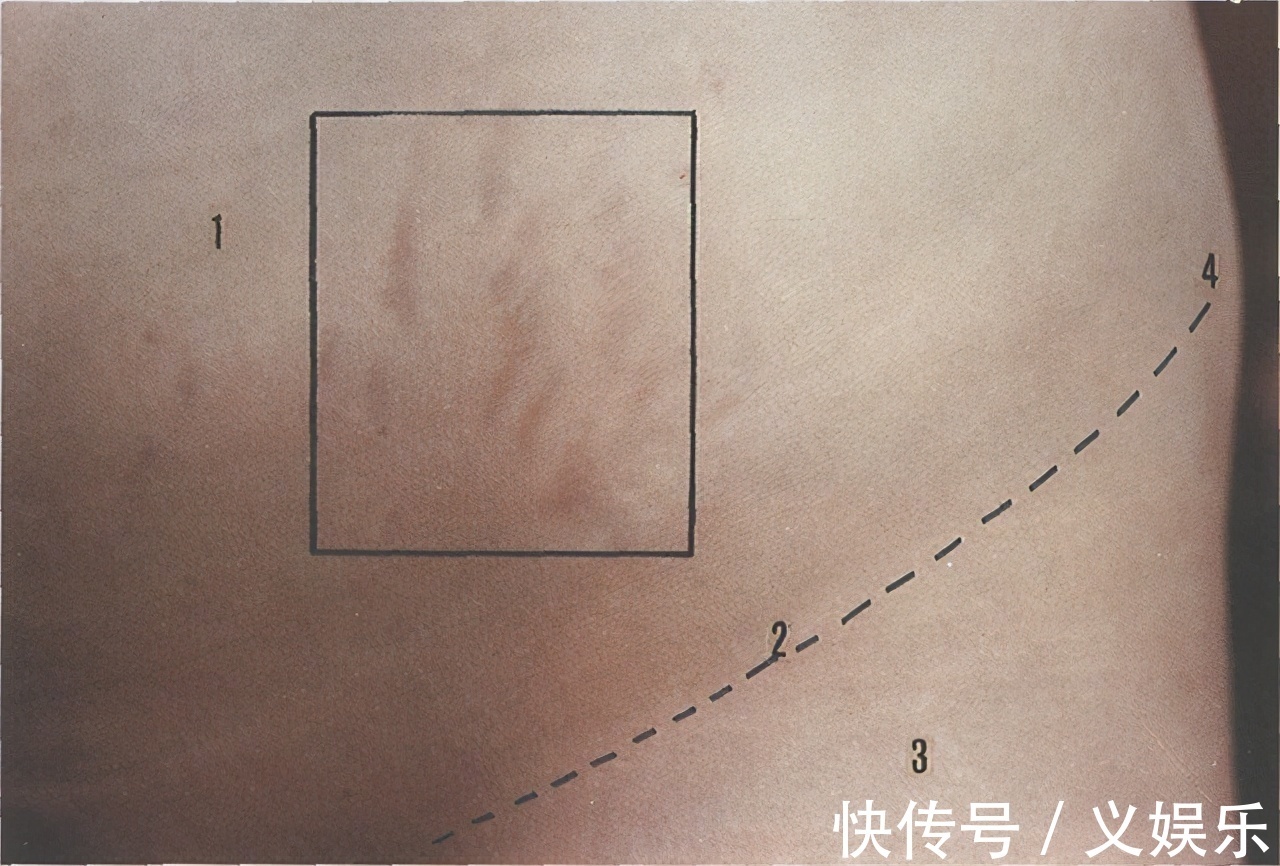 孕妈|怀孕后,为啥有人会长妊娠纹,有人却不会长和这四个因素有关