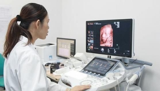 四维彩超|怀孕之后,孕妈做四维前要清楚的3件事,不然可能会白白浪费钱