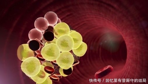 血栓|用醋泡“它”,每天吃点,血管一通到底!血栓的“死对头”!