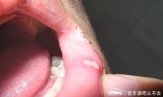 老中医|85年老中医说刷牙水里放一种东西,多年口臭去光光,一用就见效,超级管用!