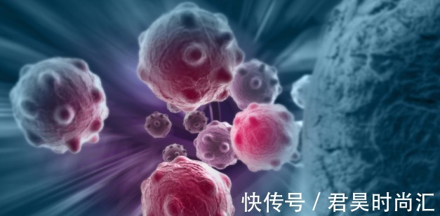 生理慧医师|在你和癌症之间,只有四步之遥!大多数人到了第二步,还不知!