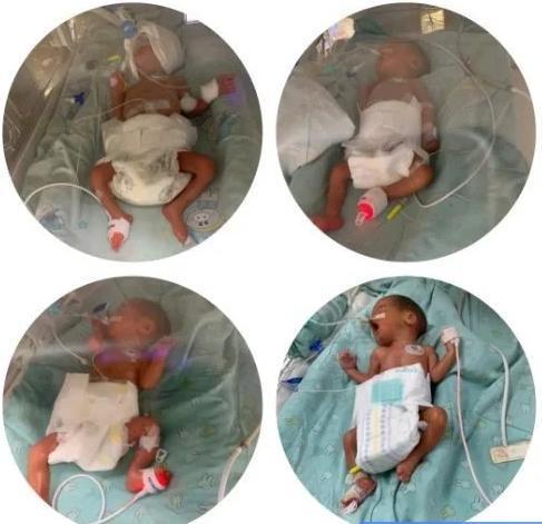 龙凤胎|宝妈生下“双龙凤胎”,概率只有百万分之一,网友:神仙家庭